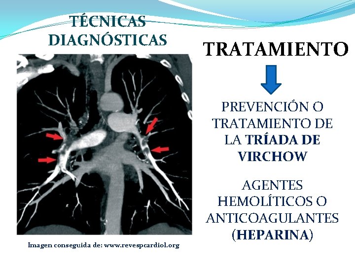 TÉCNICAS DIAGNÓSTICAS TRATAMIENTO PREVENCIÓN O TRATAMIENTO DE LA TRÍADA DE VIRCHOW Imagen conseguida de: