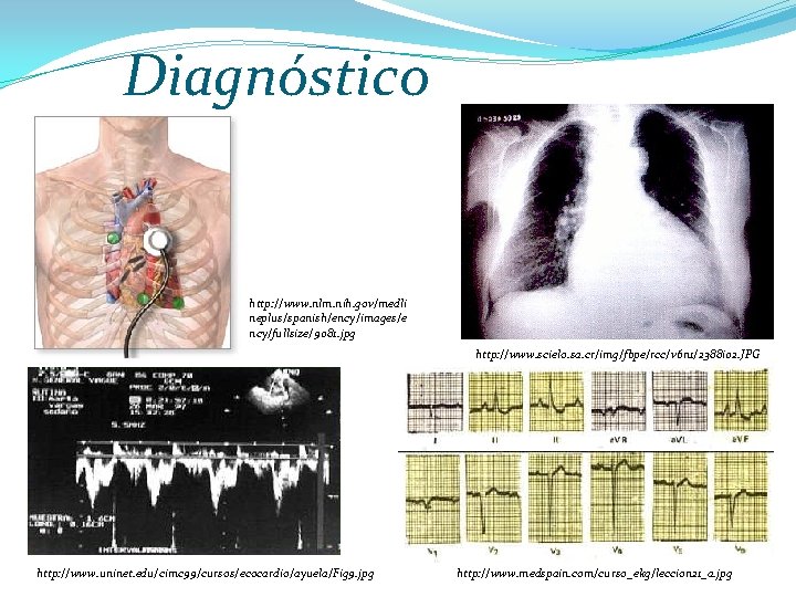 Diagnóstico http: //www. nlm. nih. gov/medli neplus/spanish/ency/images/e ncy/fullsize/9081. jpg http: //www. scielo. sa. cr/img/fbpe/rcc/v