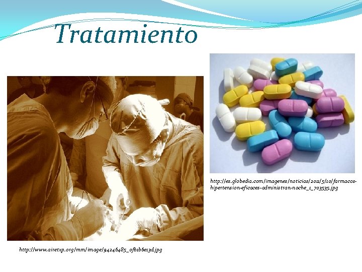 Tratamiento http: //es. globedia. com/imagenes/noticias/2011/5/10/farmacoshipertension-eficaces-administran-noche_1_703535. jpg http: //www. airetxp. org/mm/image/94246485_0 fb 1 b 6