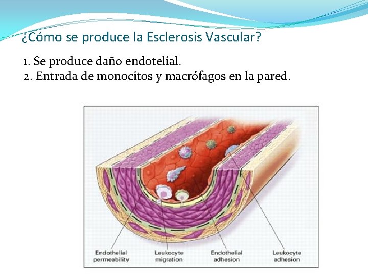 ¿Cómo se produce la Esclerosis Vascular? 1. Se produce daño endotelial. 2. Entrada de