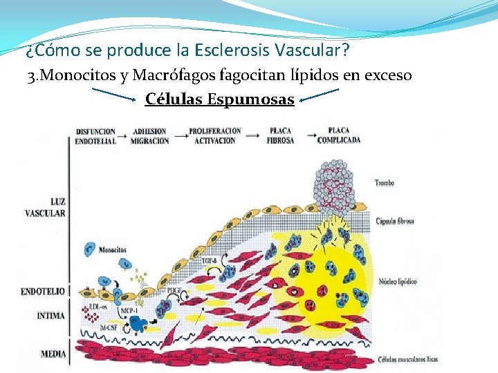 ¿Cómo se produce la Esclerosis Vascular? 3. Monocitos y Macrófagos fagocitan lípidos en exceso