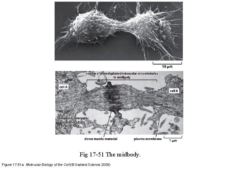 Fig 17 -51 The midbody. Figure 17 -51 a Molecular Biology of the Cell