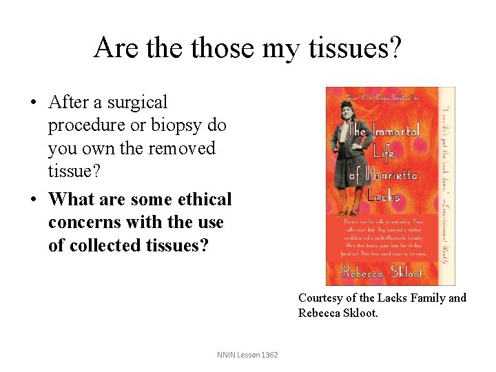 Are those my tissues? • After a surgical procedure or biopsy do you own