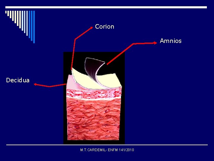 Corion Amnios Decidua M. T. CARDEMIL- ENFM 141/2010 