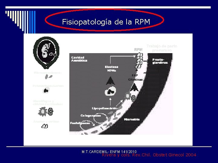 Fisiopatología de la RPM * M. T. CARDEMIL- ENFM 141/2010 Rivera y cols. Rev.