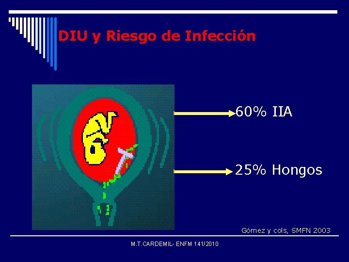 DIU y Riesgo de Infección 60% IIA 25% Hongos Gómez y cols, SMFN 2003