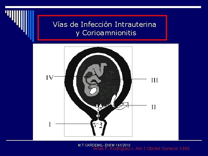 Vías de Infección Intrauterina y Corioamnionitis * M. T. CARDEMIL- ENFM 141/2010 Arias F,
