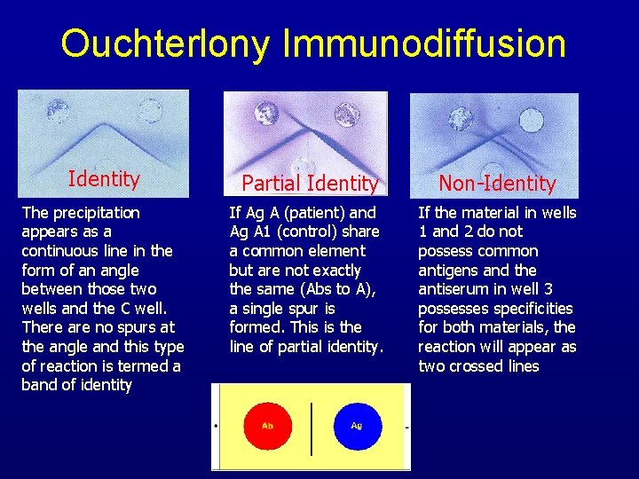 Ouchterlony Immunodiffusion Identity Partial Identity Non-Identity The precipitation appears as a continuous line in