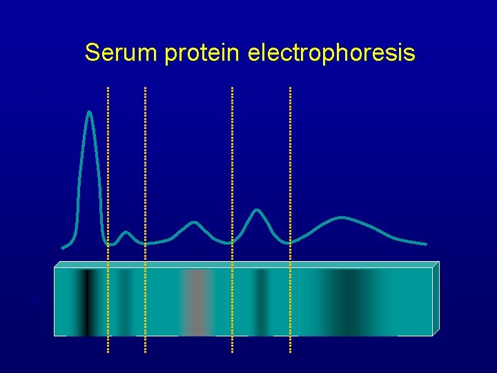 Serum protein electrophoresis Albumin 1 + 2 - 