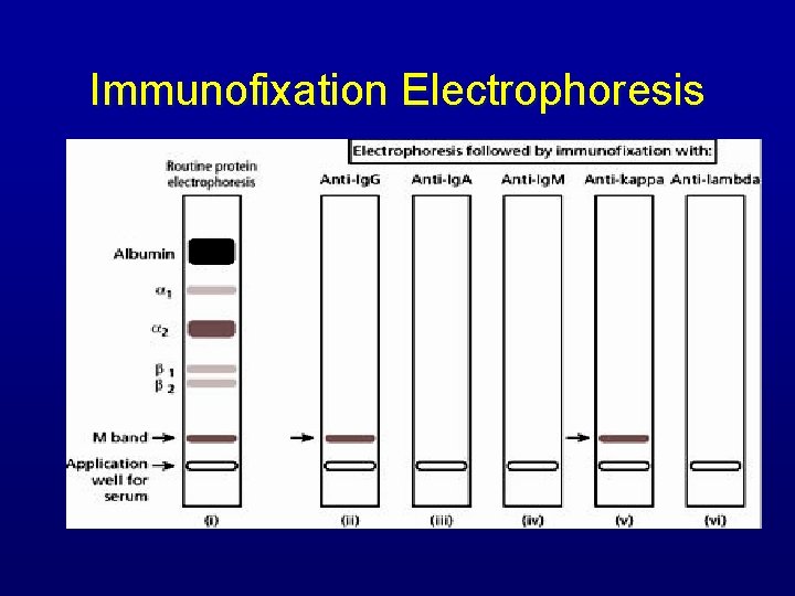 Immunofixation Electrophoresis 