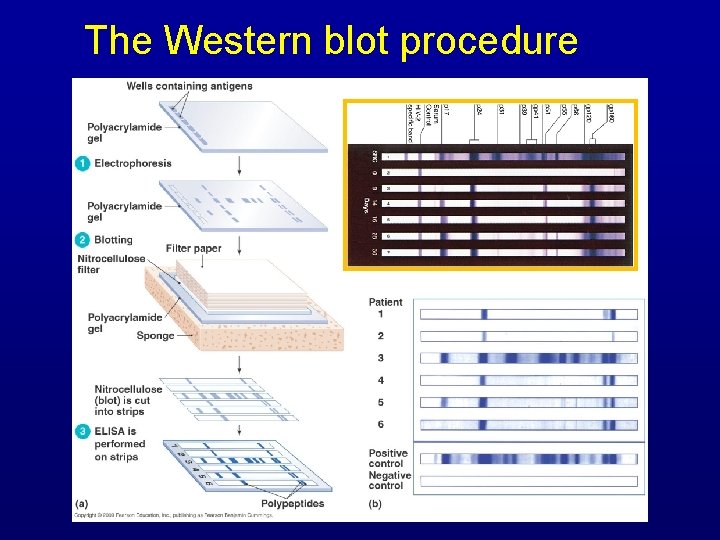 The Western blot procedure [INSERT FIGURE 17. 17] 