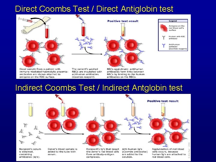 Direct Coombs Test / Direct Antiglobin test Indirect Coombs Test / Indirect Antglobin test