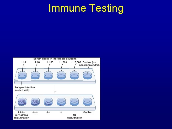 Immune Testing 