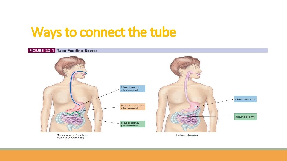 Ways to connect the tube 