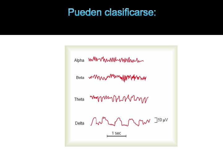 Pueden clasificarse: 