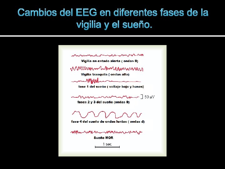 Cambios del EEG en diferentes fases de la vigilia y el sueño. 