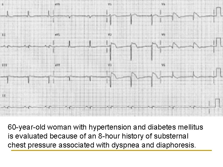 60 -year-old woman with hypertension and diabetes mellitus is evaluated because of an 8