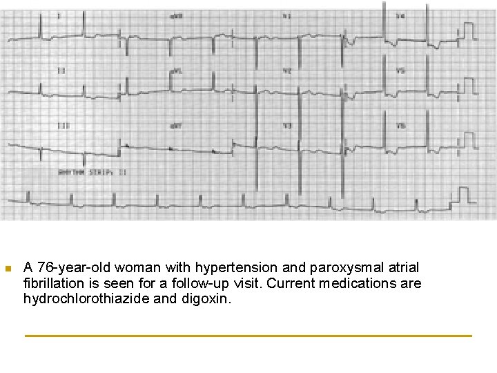 n A 76 -year-old woman with hypertension and paroxysmal atrial fibrillation is seen for