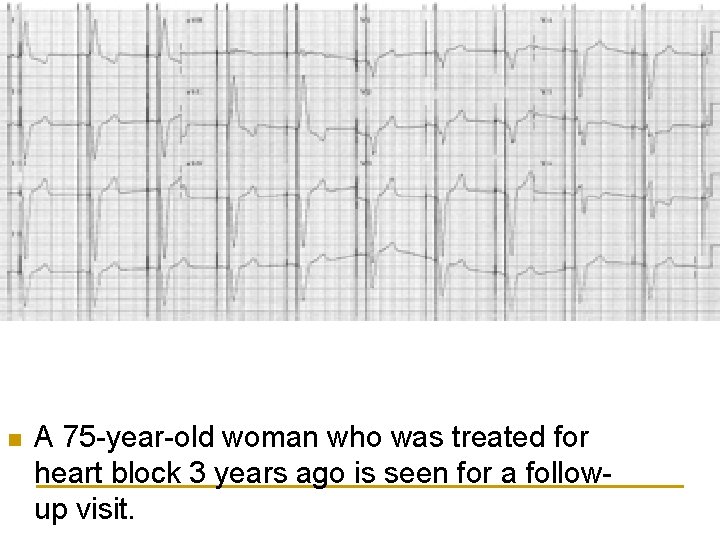 n A 75 -year-old woman who was treated for heart block 3 years ago