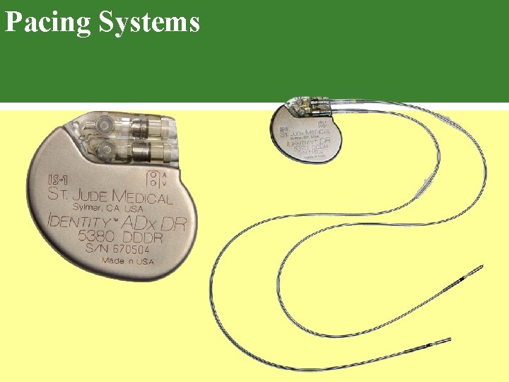 Pacing Systems 