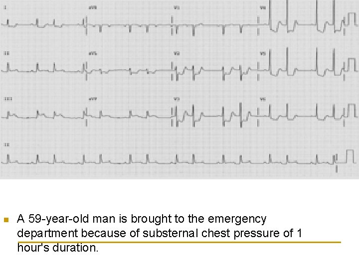 n A 59 -year-old man is brought to the emergency department because of substernal