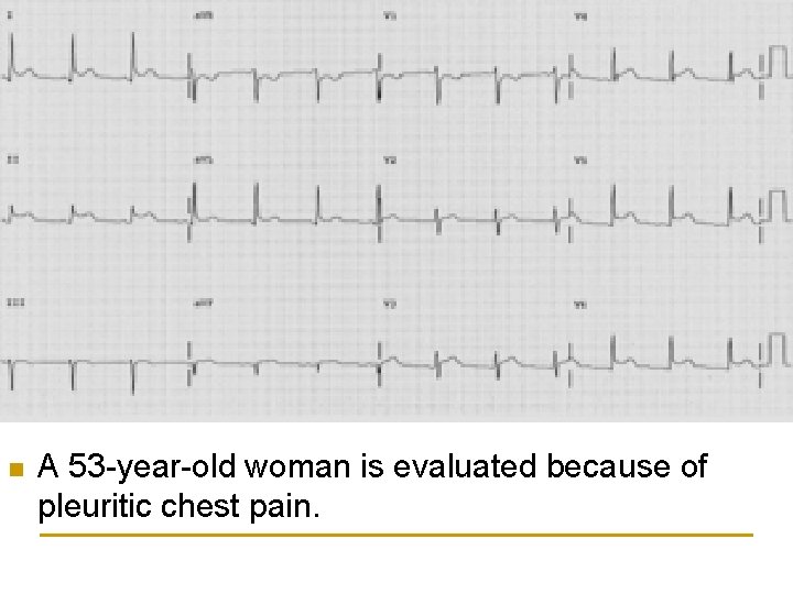 n A 53 -year-old woman is evaluated because of pleuritic chest pain. 