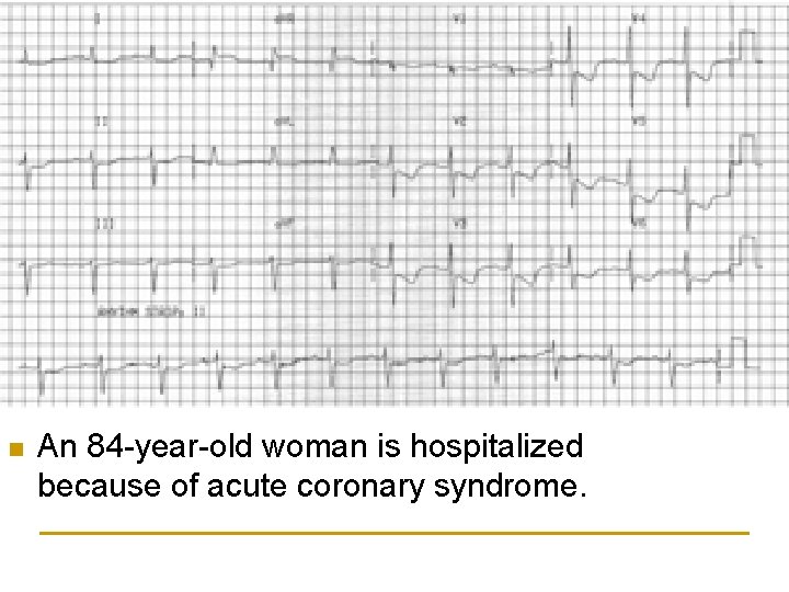 n An 84 -year-old woman is hospitalized because of acute coronary syndrome. 