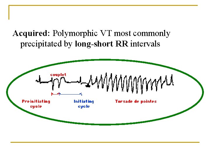 Acquired: Polymorphic VT most commonly precipitated by long-short RR intervals 