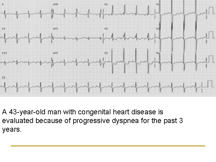 A 43 -year-old man with congenital heart disease is evaluated because of progressive dyspnea
