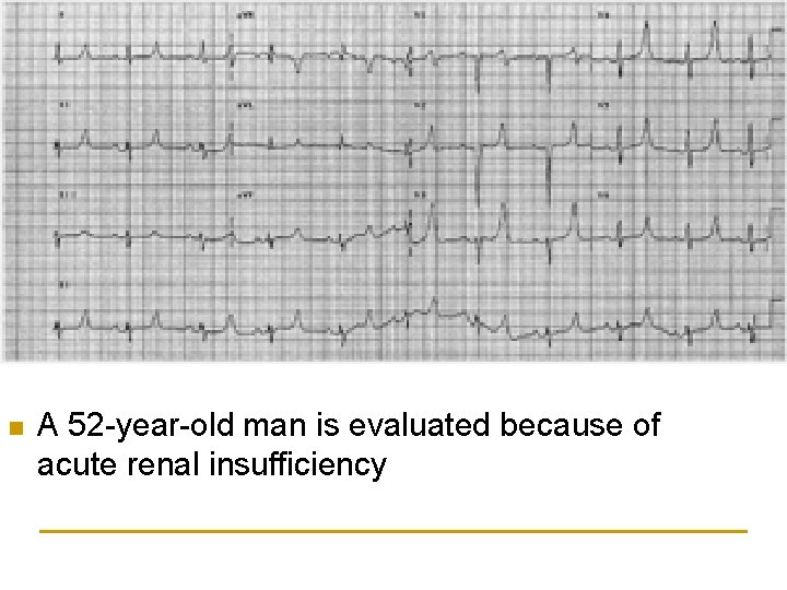 n A 52 -year-old man is evaluated because of acute renal insufficiency 
