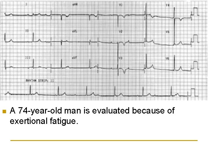 n A 74 -year-old man is evaluated because of exertional fatigue. 