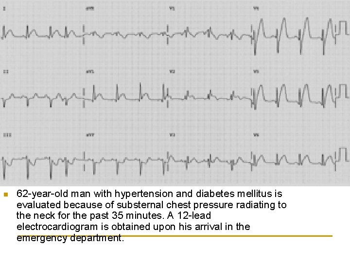 n 62 -year-old man with hypertension and diabetes mellitus is evaluated because of substernal