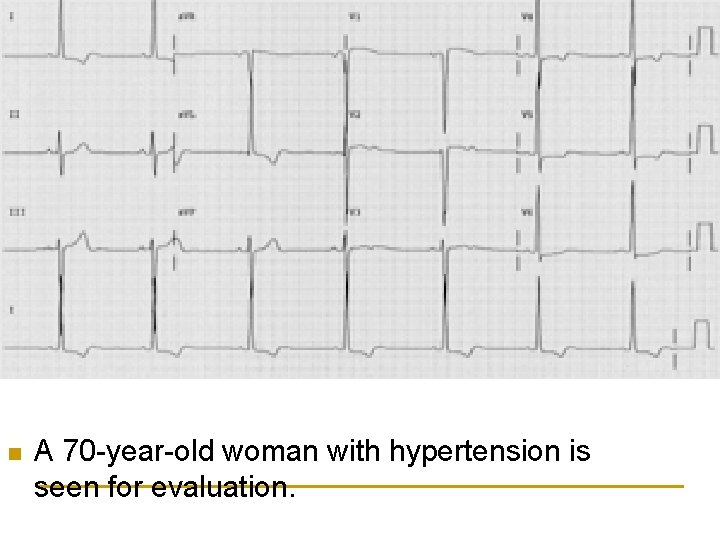 n A 70 -year-old woman with hypertension is seen for evaluation. 