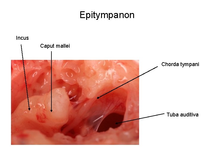 Epitympanon Incus Caput mallei Chorda tympani Tuba auditiva 