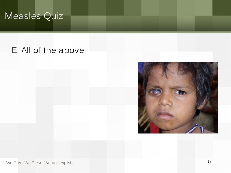 Measles Quiz E: All of the above We Care. We Serve. We Accomplish. 17