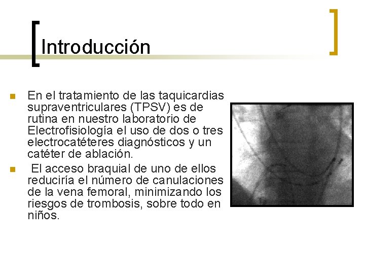 Introducción n n En el tratamiento de las taquicardias supraventriculares (TPSV) es de rutina