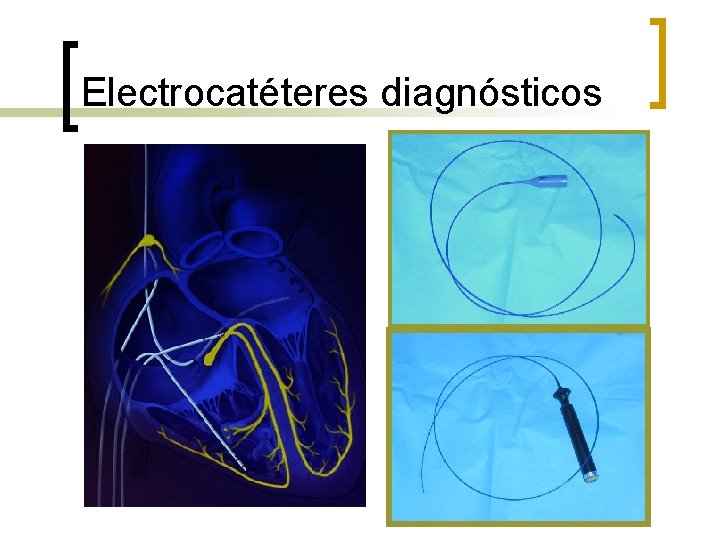 Electrocatéteres diagnósticos 