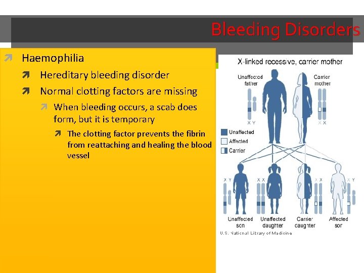 Bleeding Disorders Haemophilia Hereditary bleeding disorder Normal clotting factors are missing When bleeding occurs,