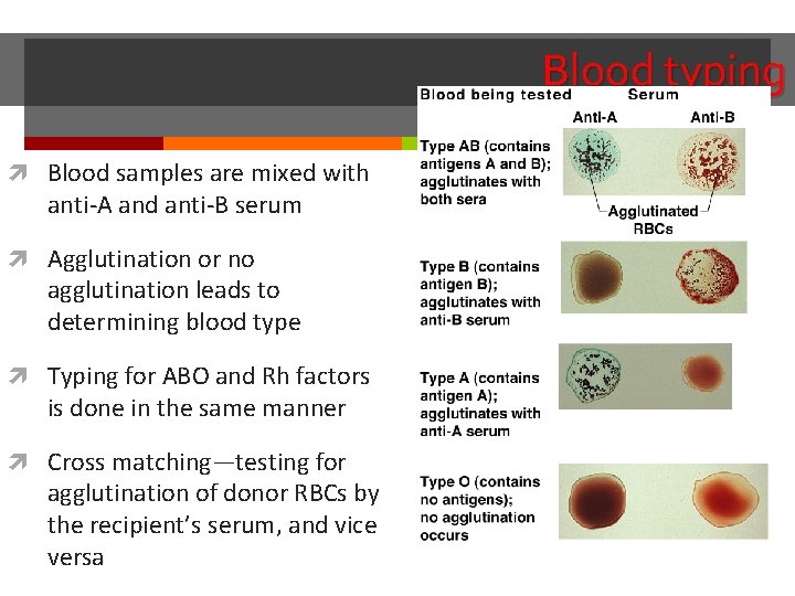 Blood typing Blood samples are mixed with anti-A and anti-B serum Agglutination or no