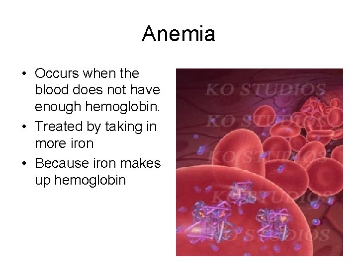 Anemia • Occurs when the blood does not have enough hemoglobin. • Treated by