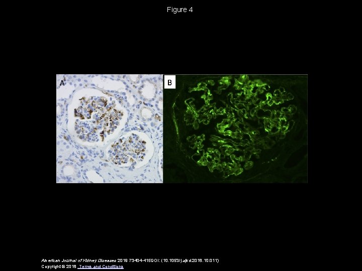 Figure 4 American Journal of Kidney Diseases 2019 73404 -415 DOI: (10. 1053/j. ajkd.