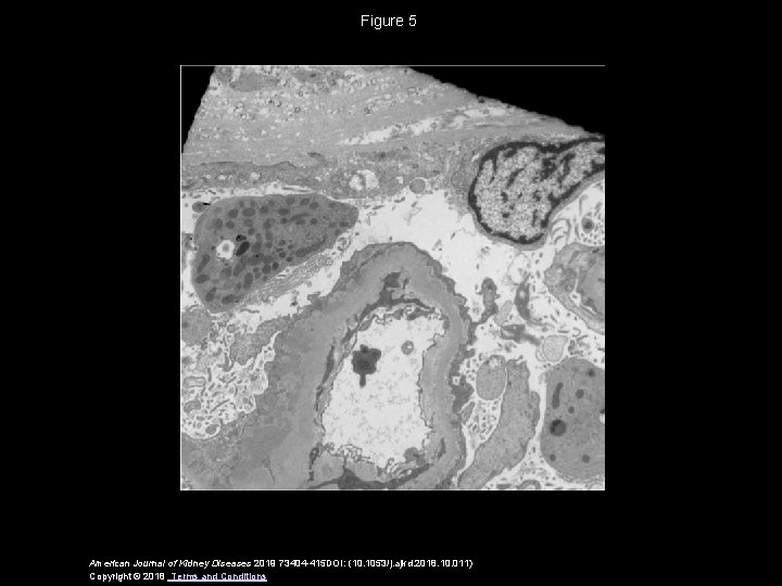 Figure 5 American Journal of Kidney Diseases 2019 73404 -415 DOI: (10. 1053/j. ajkd.