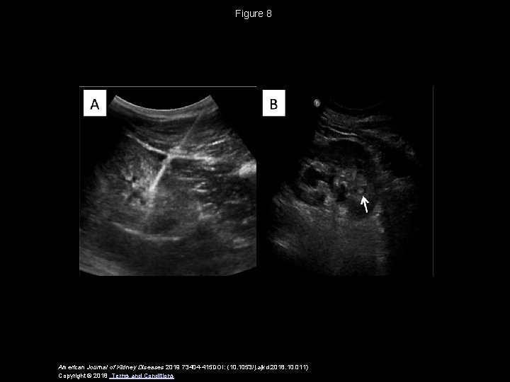 Figure 8 American Journal of Kidney Diseases 2019 73404 -415 DOI: (10. 1053/j. ajkd.