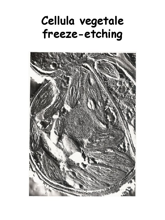 Cellula vegetale freeze-etching 