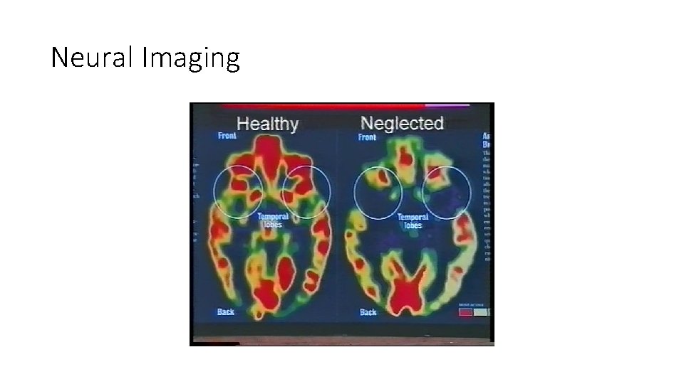 Neural Imaging 