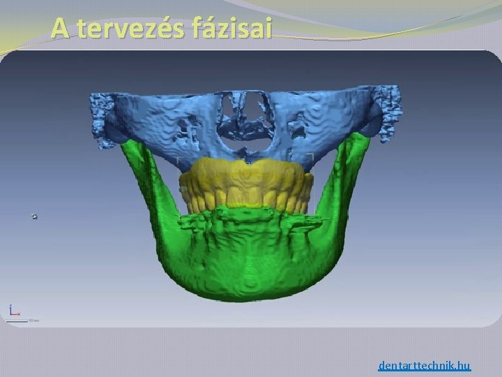 A tervezés fázisai dentarttechnik. hu 