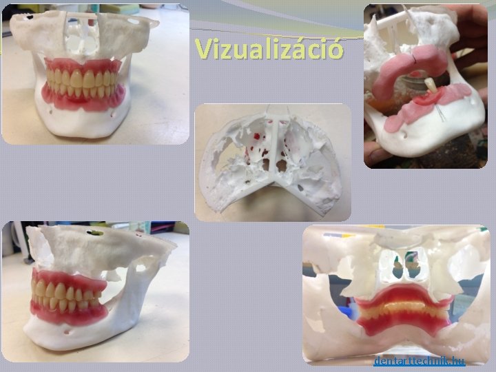 Vizualizáció dentarttechnik. hu 