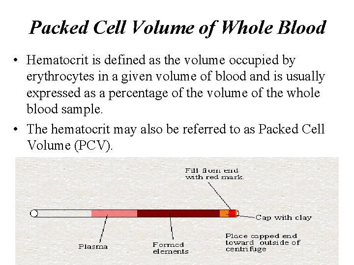 Packed Cell Volume of Whole Blood • Hematocrit is defined as the volume occupied