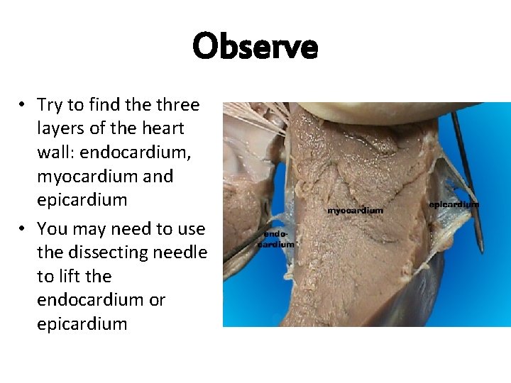 Observe • Try to find the three layers of the heart wall: endocardium, myocardium