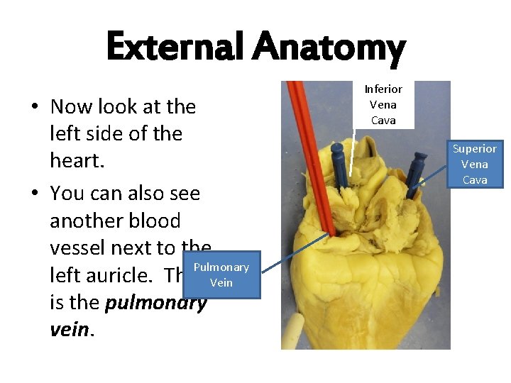 External Anatomy • Now look at the left side of the heart. • You